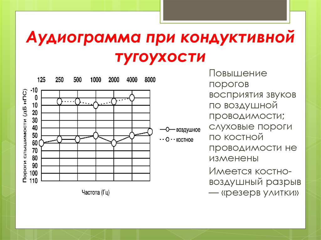 тональная пороговая аудиометрия